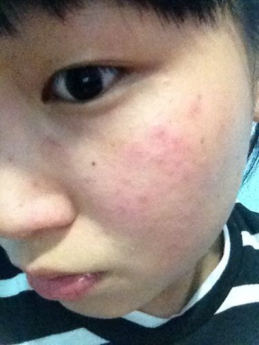 甲醛超標小孩有何反應